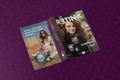 retina 11-02